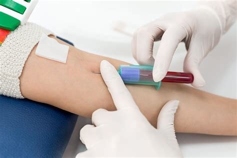 independent phlebotomist