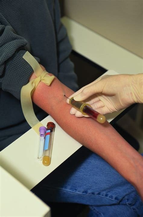 private phlebotomist contractor
